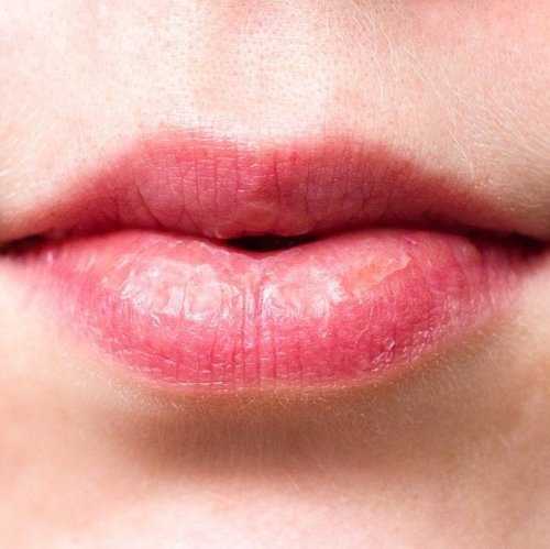 Lips Quiz: Trivia Questions and Answers